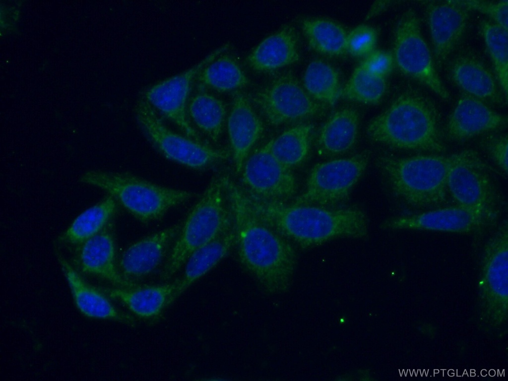 RAB8 Polyclonal antibody