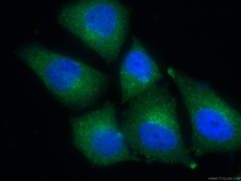 TPD52L2 Polyclonal antibody