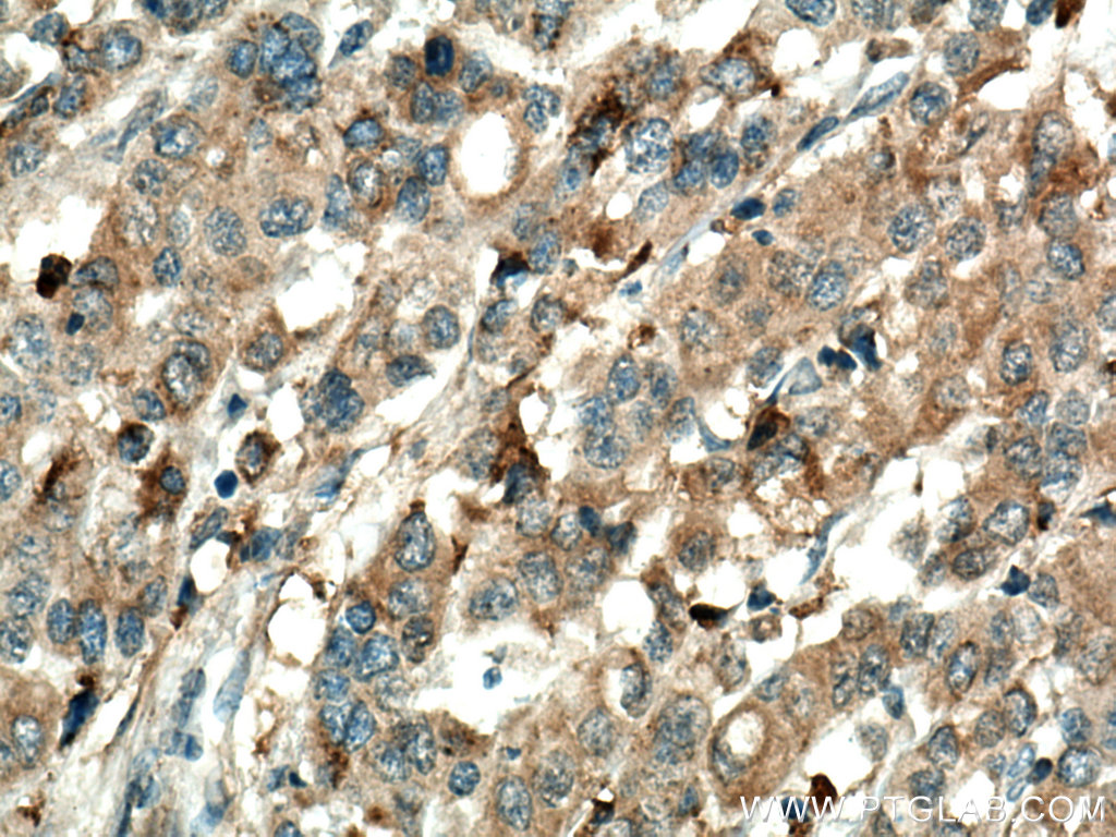 Annexin A3 Polyclonal antibody