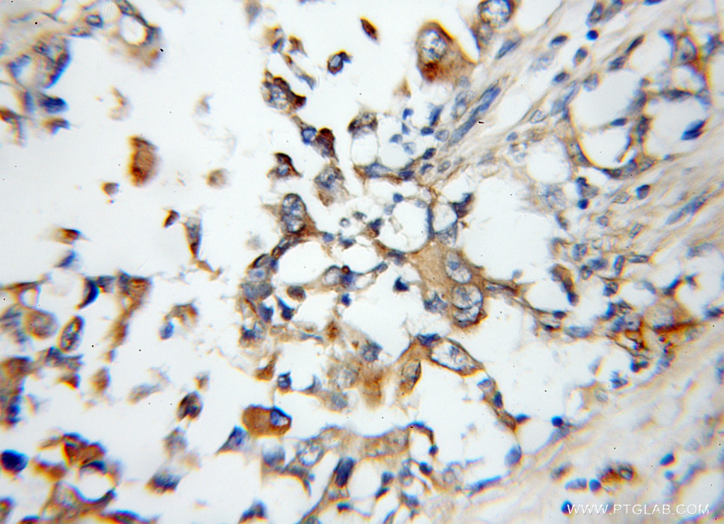 Arylsulfatase D Polyclonal antibody