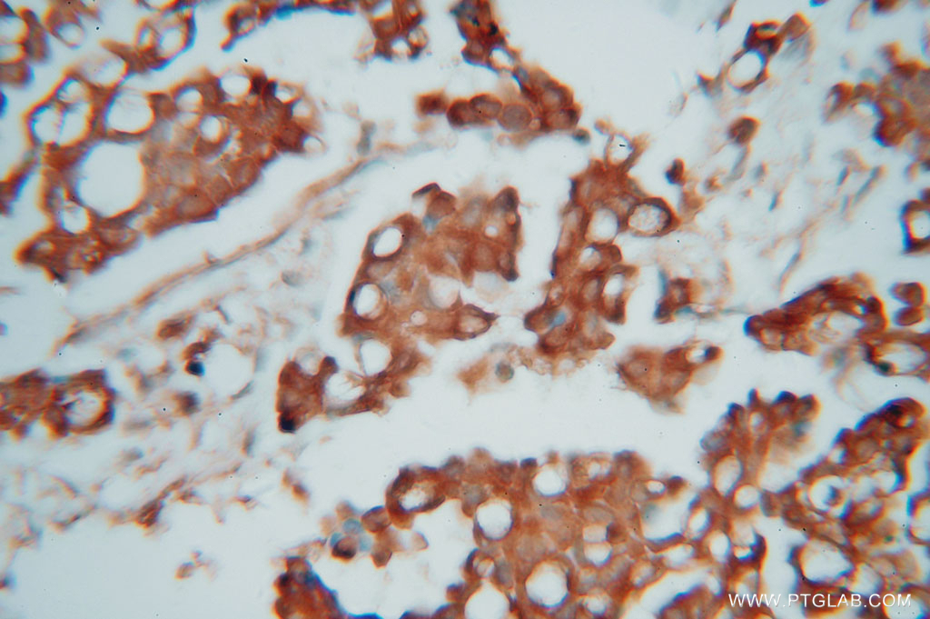 CAPZA1 Polyclonal antibody
