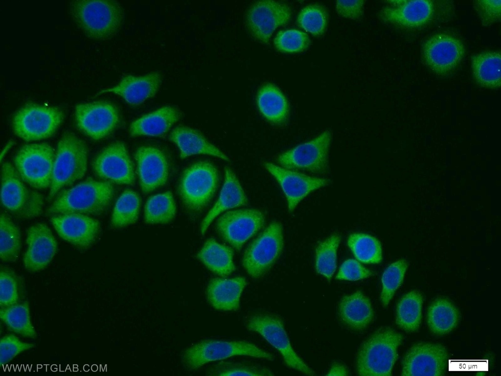 CYB5R1 Polyclonal antibody