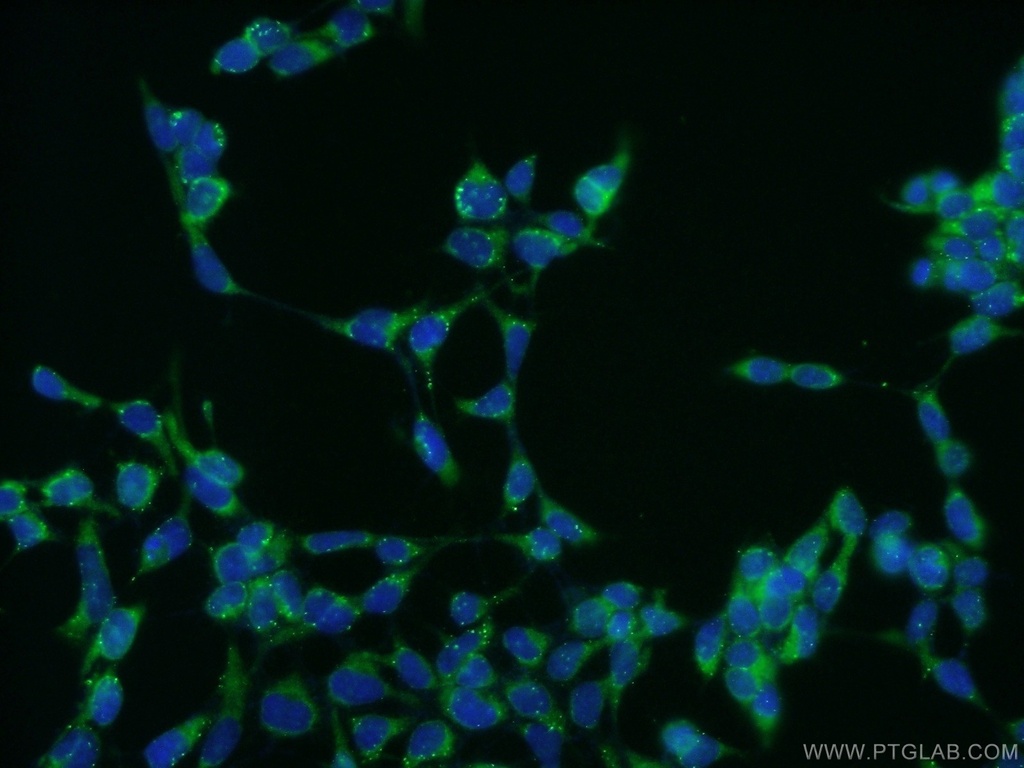 CILP2 Polyclonal antibody