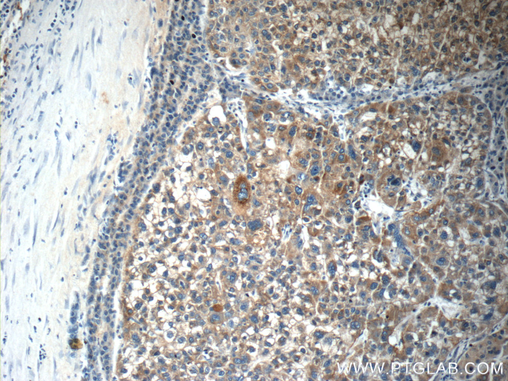 C4BPA Polyclonal antibody