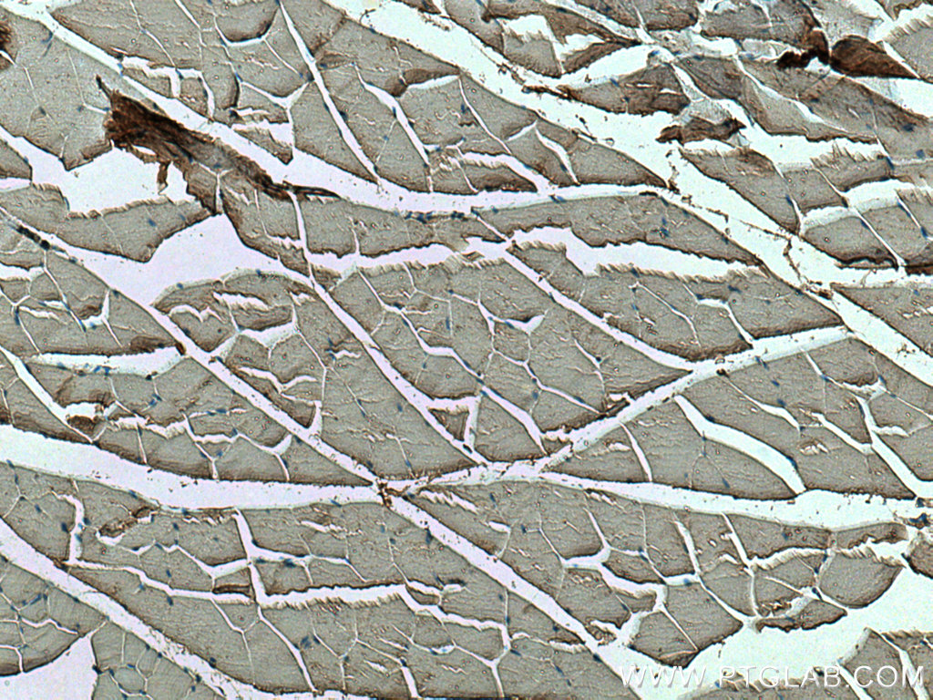 SDC4 Polyclonal antibody