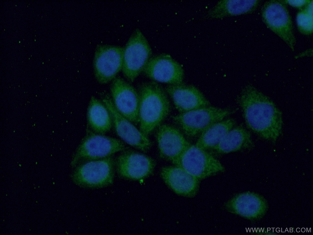 ANKRD2 Polyclonal antibody
