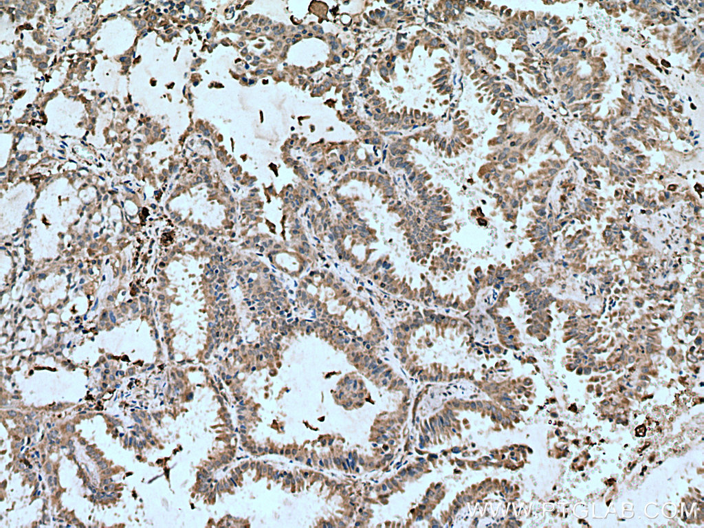 VAMP5 Polyclonal antibody