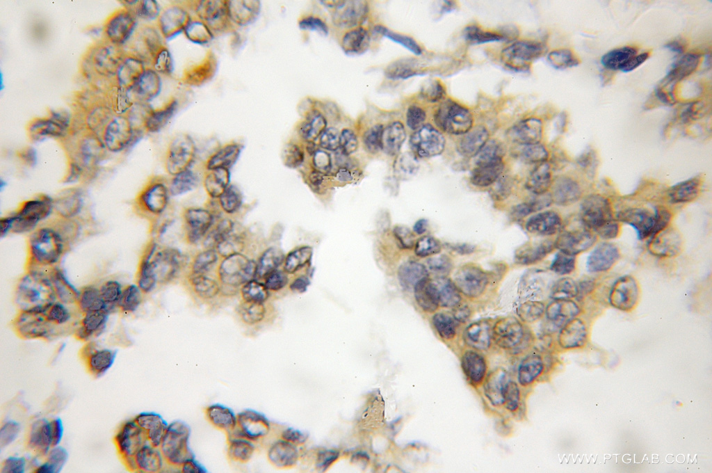CIB1 Polyclonal antibody