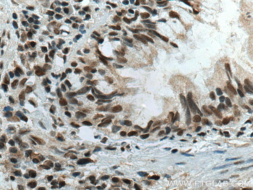 CBX5 Polyclonal antibody