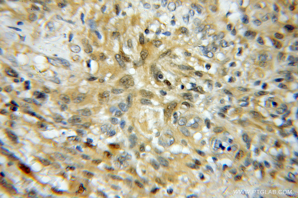 UBE2K Polyclonal antibody
