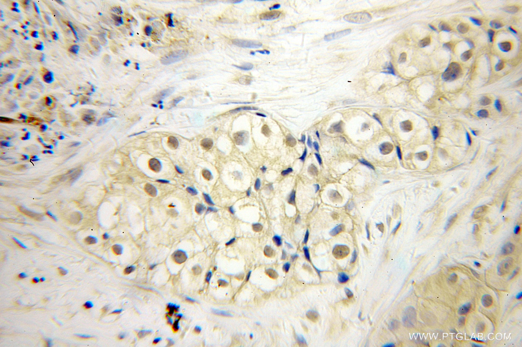 SDCCAG1 Polyclonal antibody