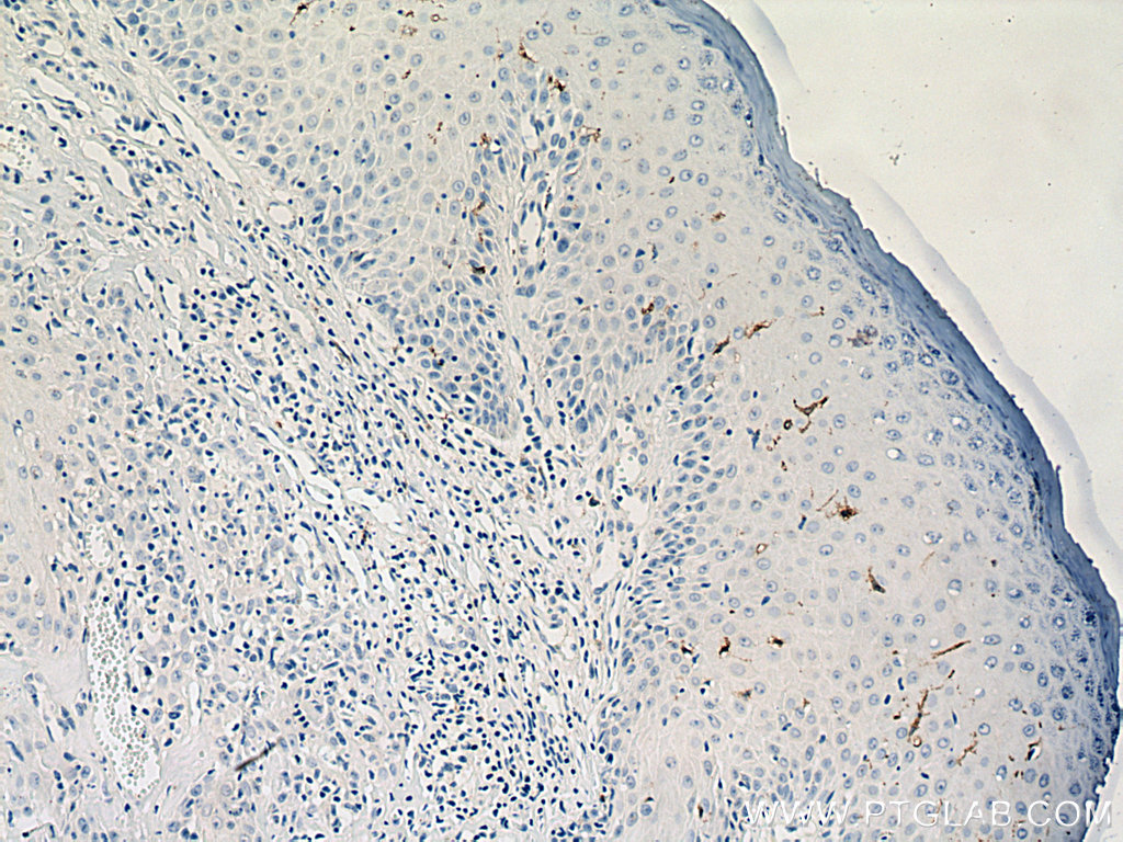 Langerin Polyclonal antibody