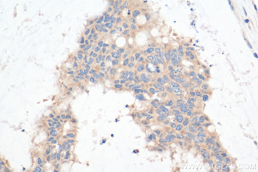 STBD1 Polyclonal antibody