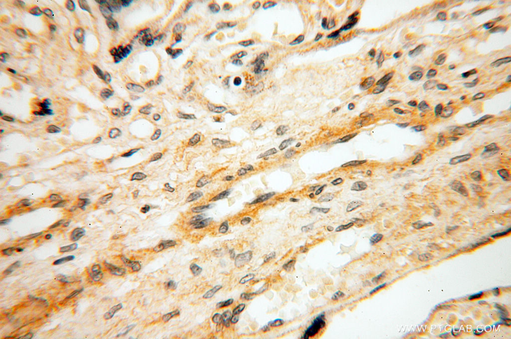SRPX2 Polyclonal antibody