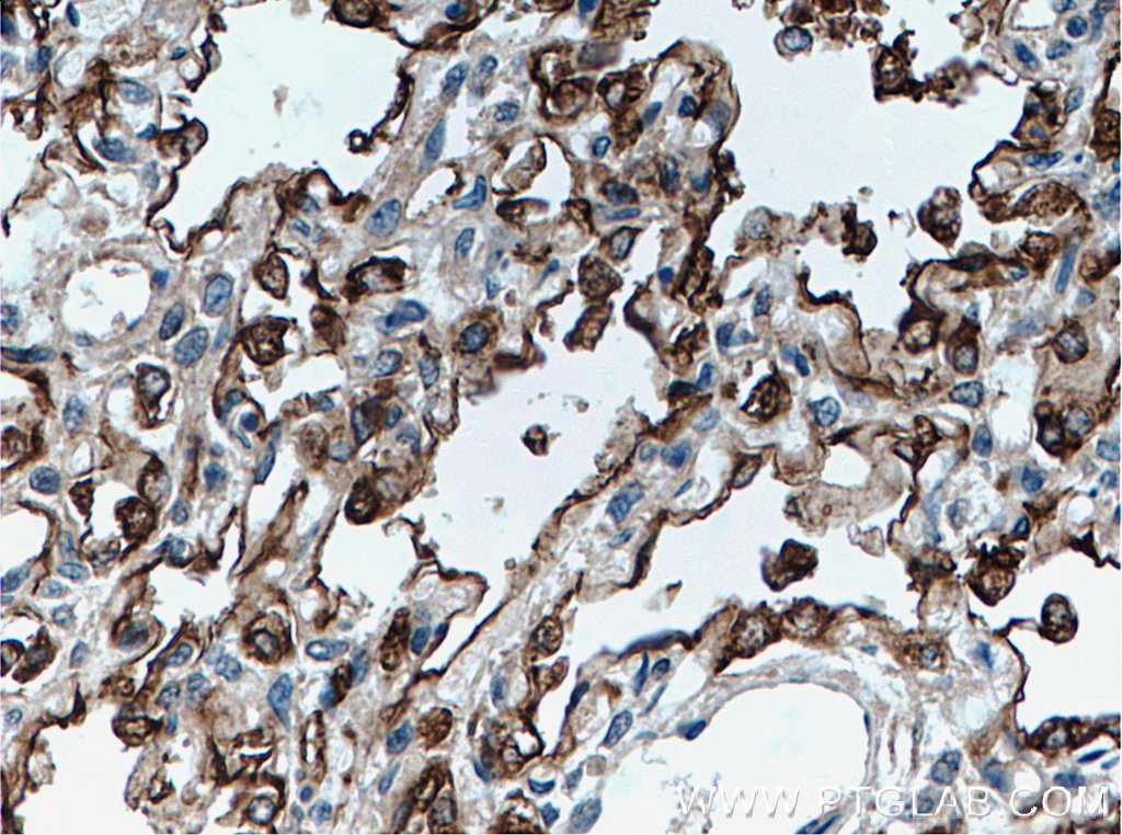 SFTPA1 Polyclonal antibody