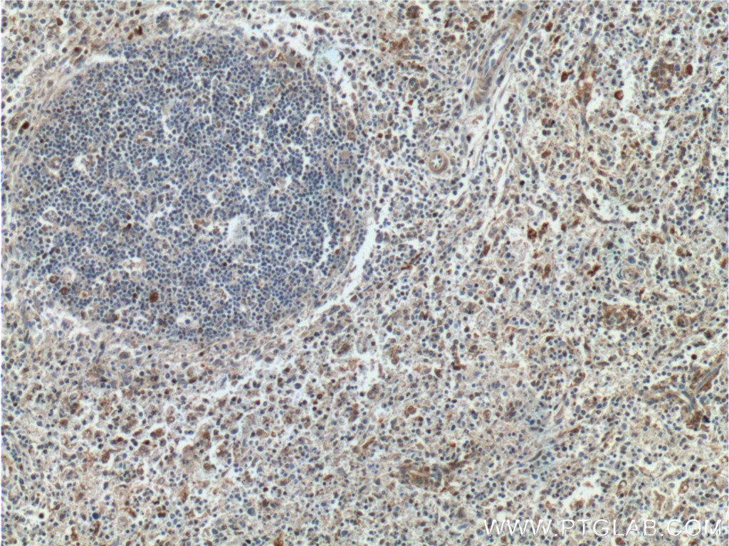 GBP2 Polyclonal antibody