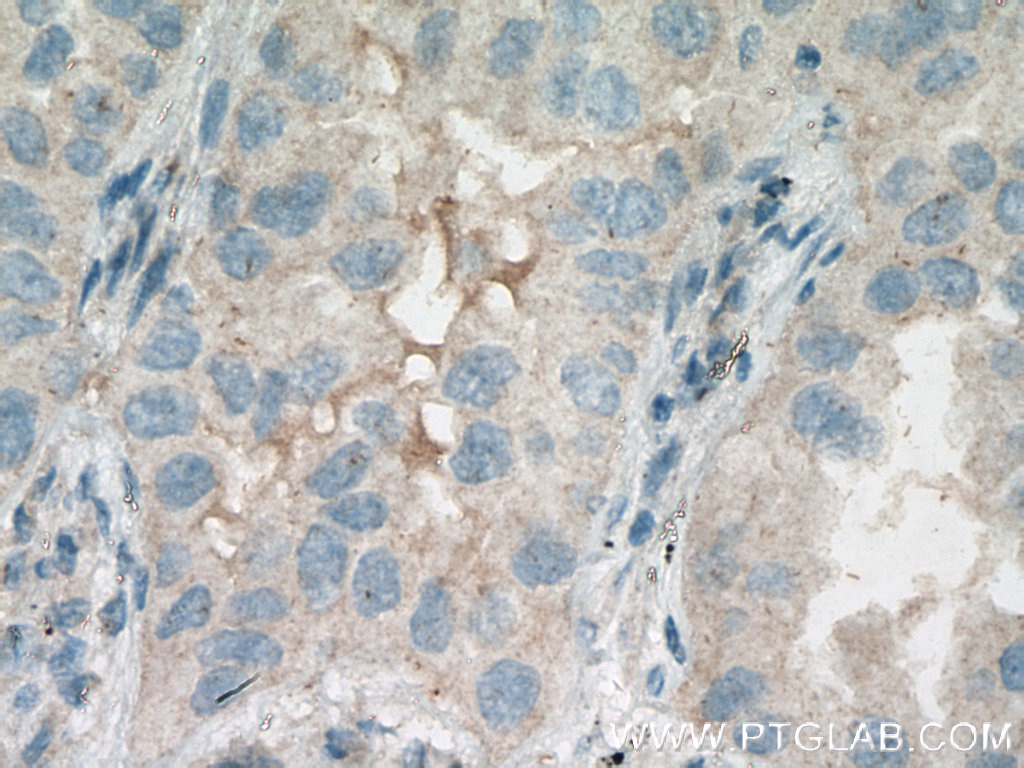 HSD17B6 Polyclonal antibody