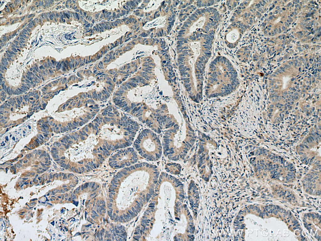 DLEU1 Polyclonal antibody