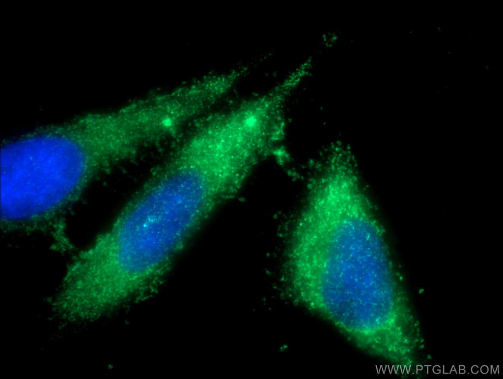 Ficolin-3 Polyclonal antibody