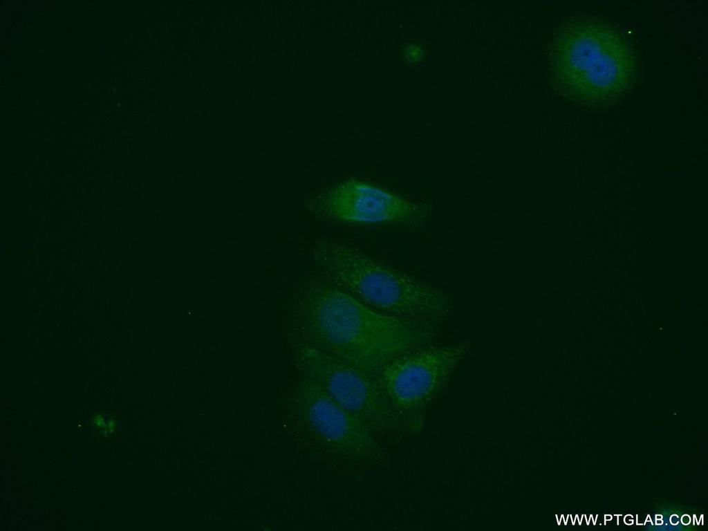 HNMT Polyclonal antibody