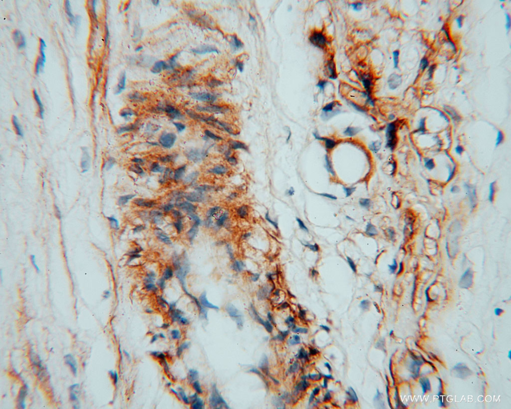 CSHL1 Polyclonal antibody