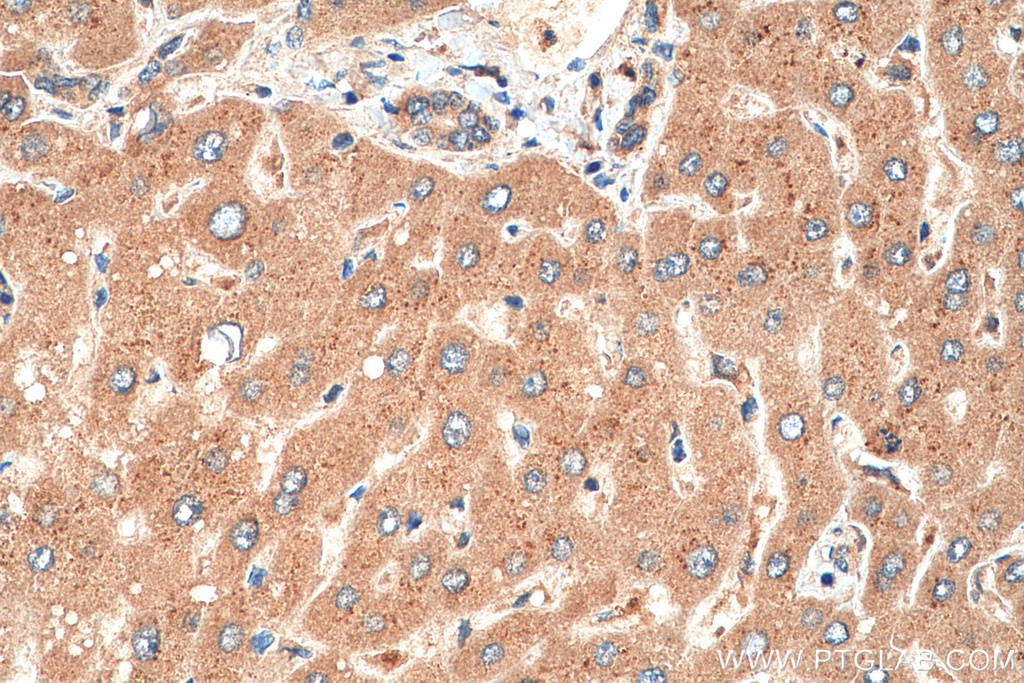 AGGF1 Polyclonal antibody