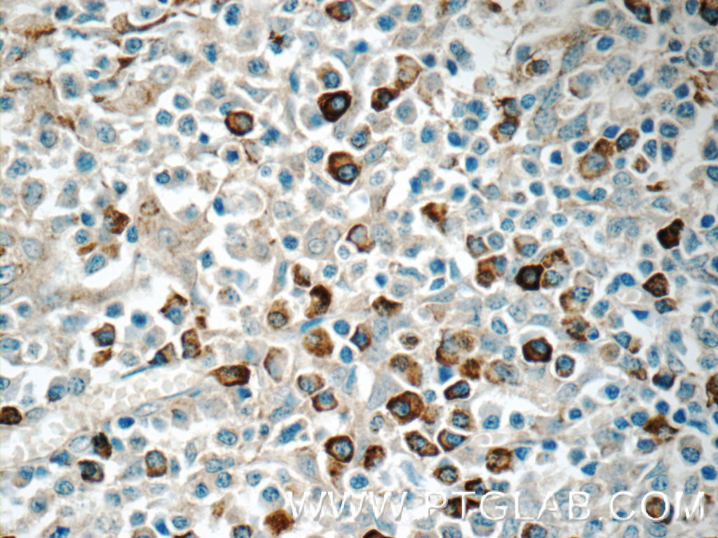 TRA Polyclonal antibody