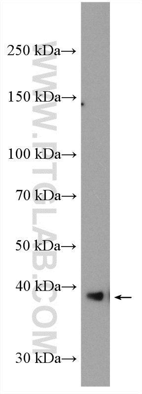 GRAP2 Polyclonal antibody
