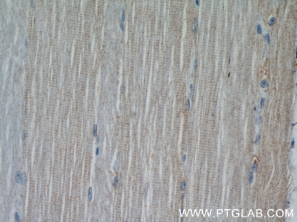 XIRP2 Polyclonal antibody