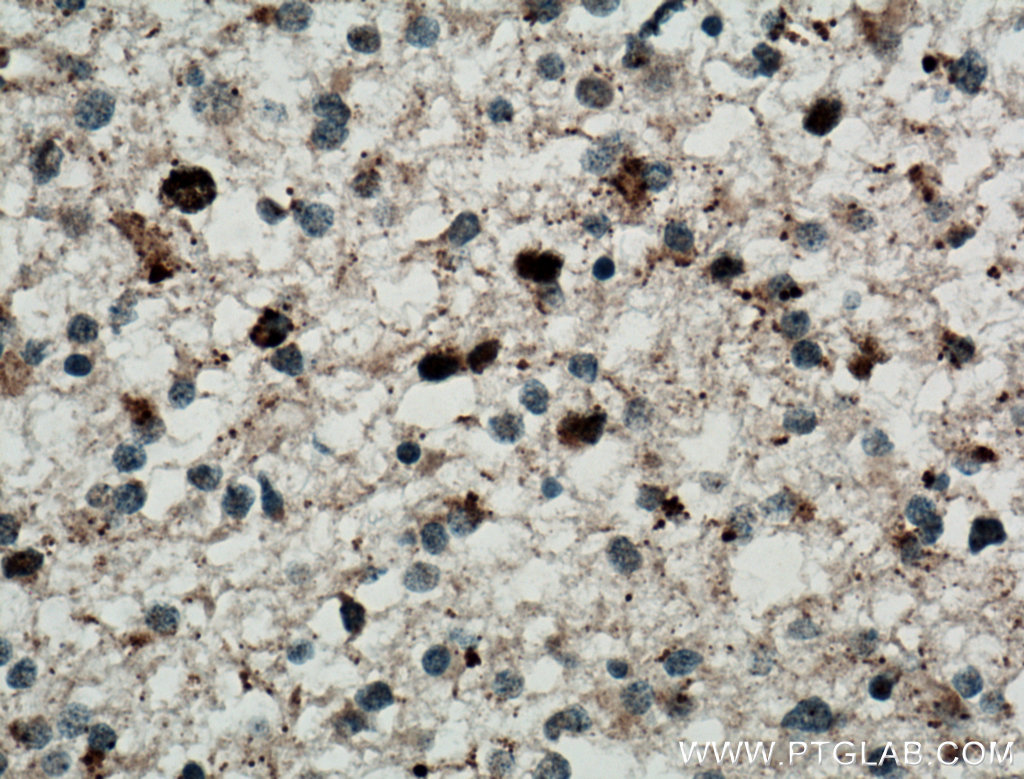 TERF1 Polyclonal antibody
