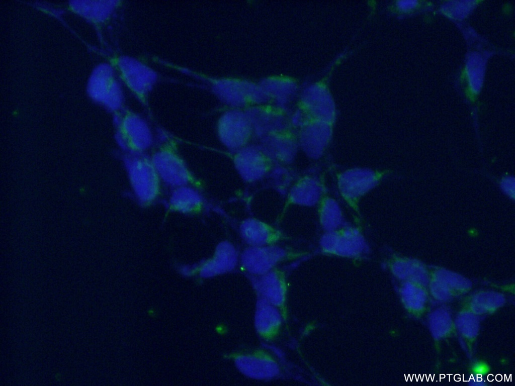 DGKE Polyclonal antibody