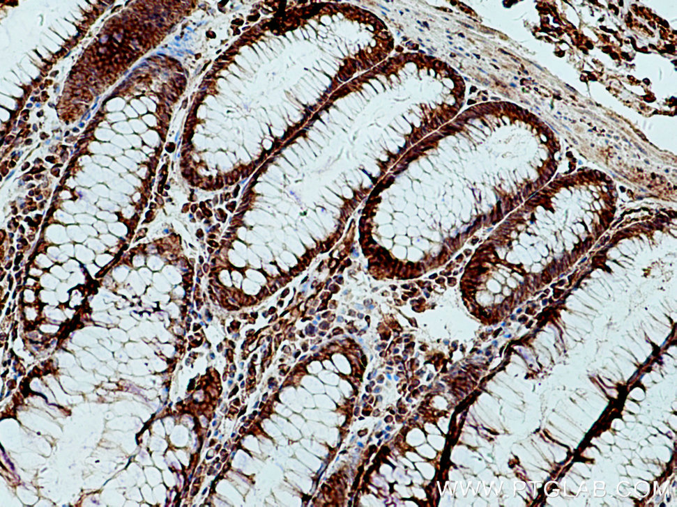 Sec8 Polyclonal antibody