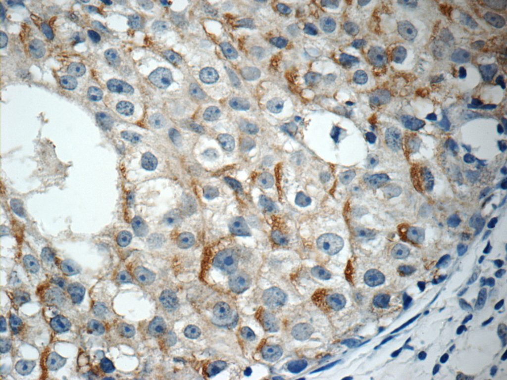 RABL3 Polyclonal antibody
