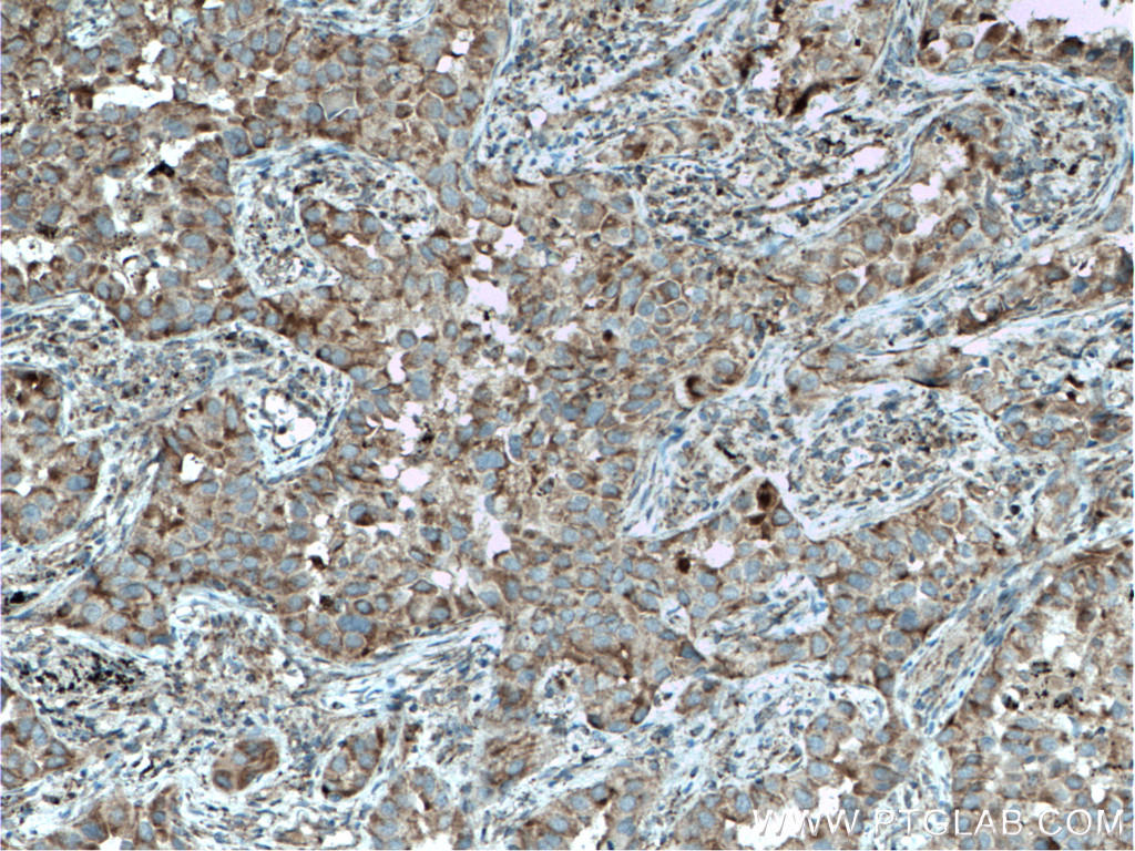 ST2 Polyclonal antibody