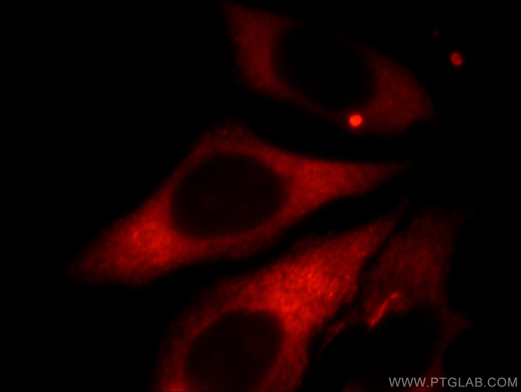 Kininogen 1 Polyclonal antibody