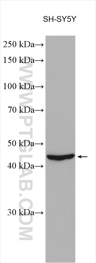 TMEFF2 Polyclonal antibody