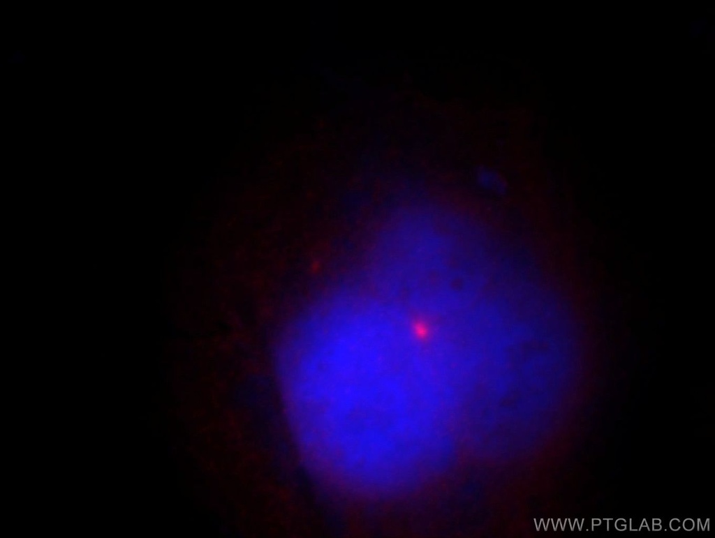 CSPP1 Polyclonal antibody