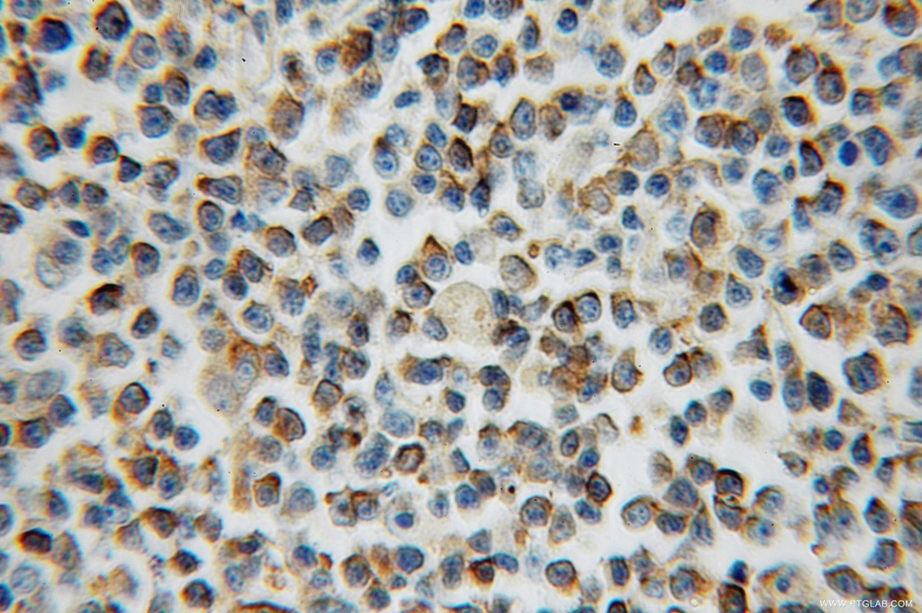 ARL15 Polyclonal antibody
