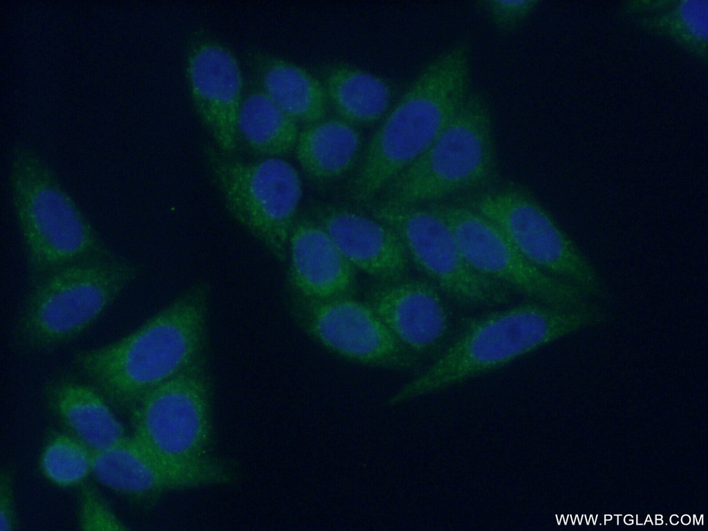 COMMD1 Polyclonal antibody
