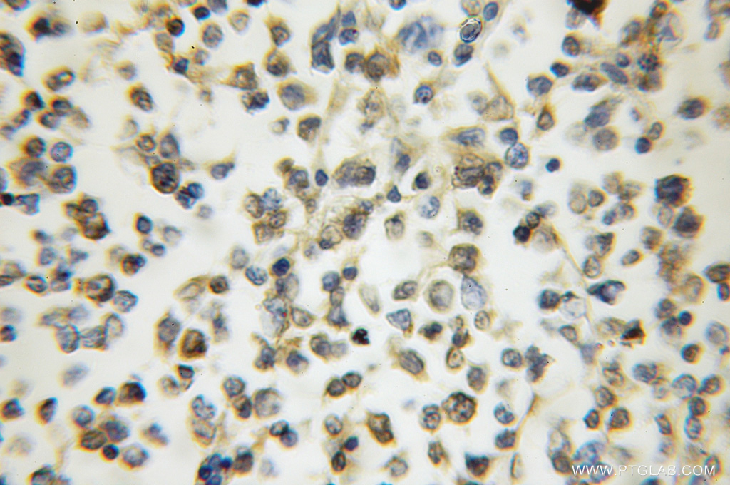 ARHGAP15 Polyclonal antibody