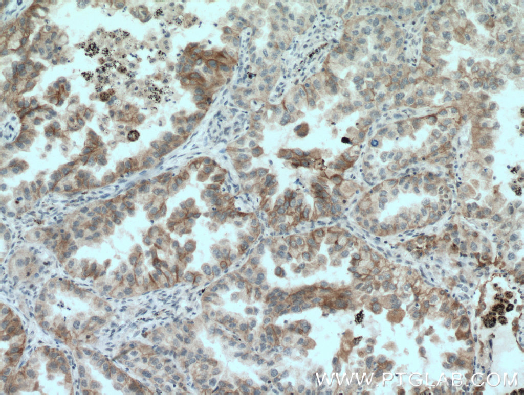 GAS2 Polyclonal antibody