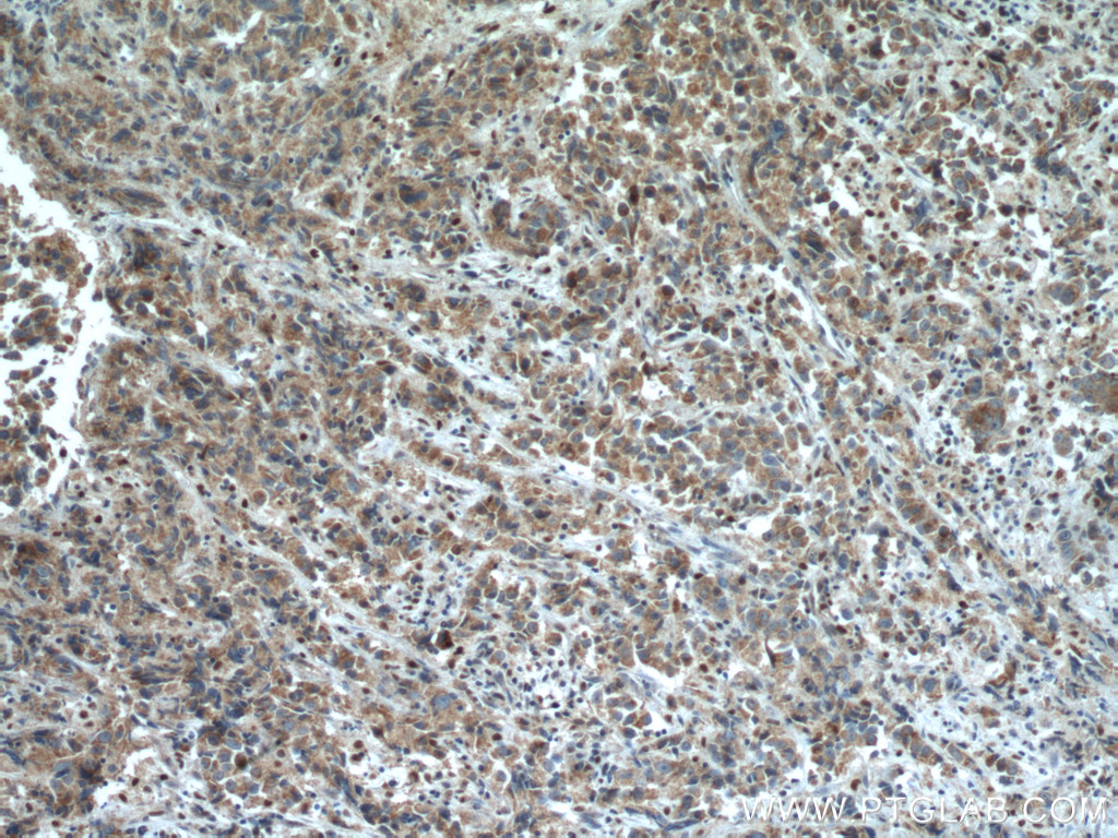 STEAP4 Polyclonal antibody
