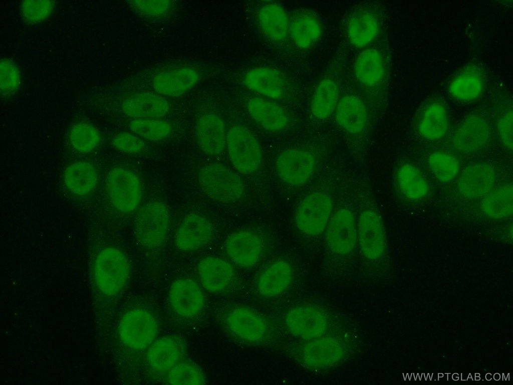 ATF1 Polyclonal antibody