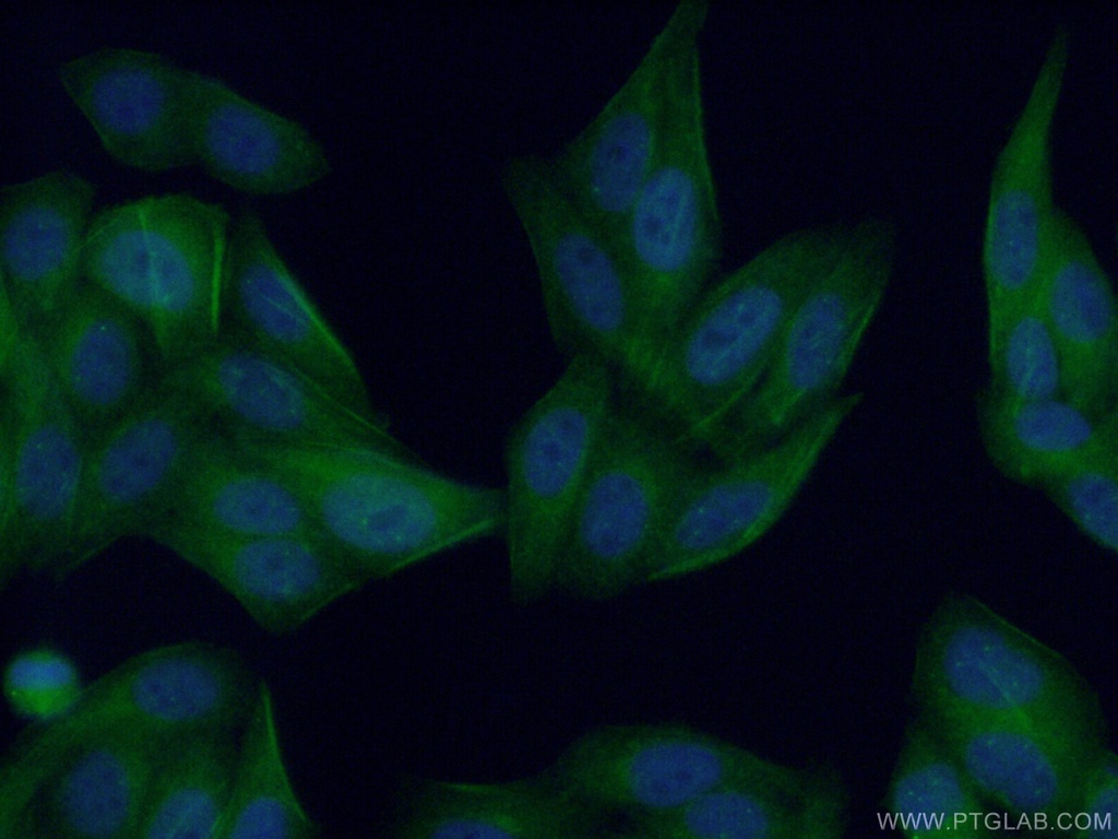 DYNLT1 Polyclonal antibody