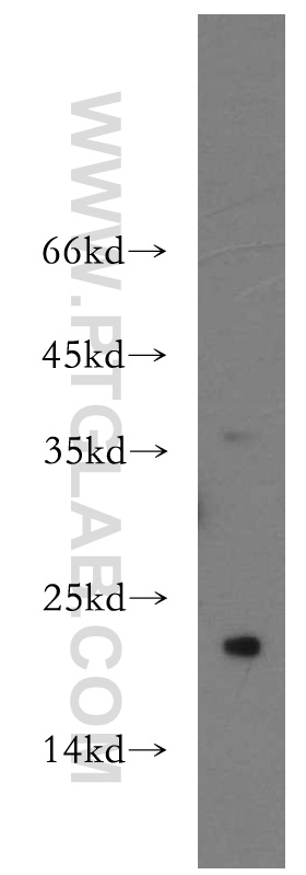 SPANXC Polyclonal antibody