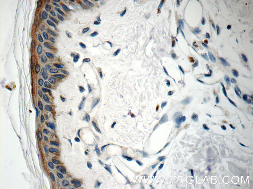 SPRR1B Polyclonal antibody