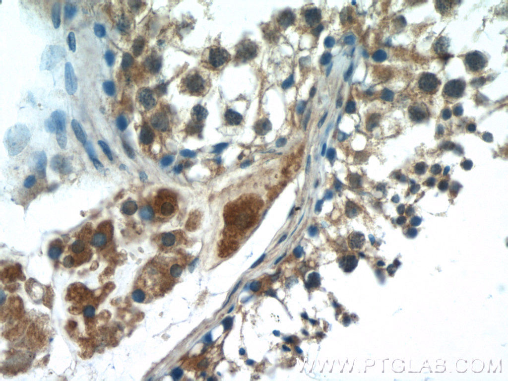 HSFY1 Polyclonal antibody