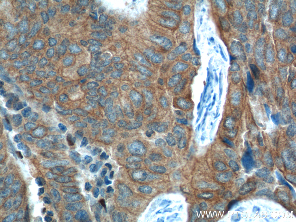 FANCA Polyclonal antibody