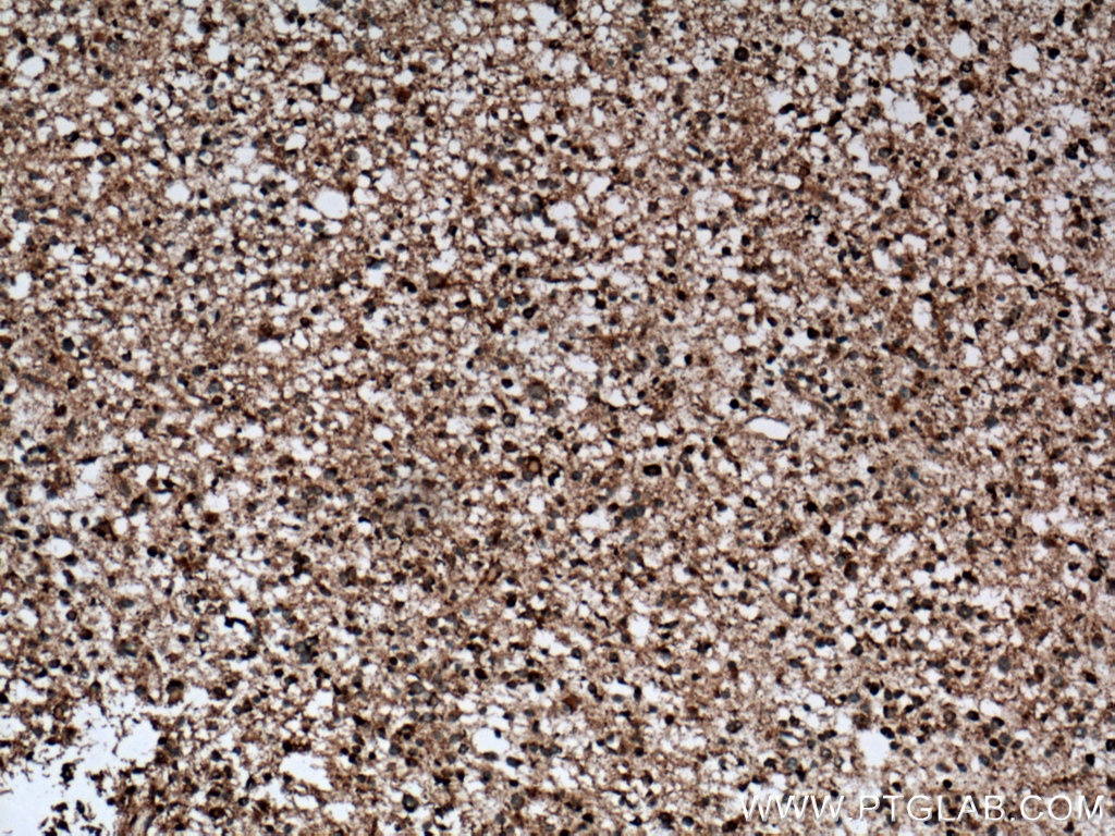 GDAP1L1 Polyclonal antibody