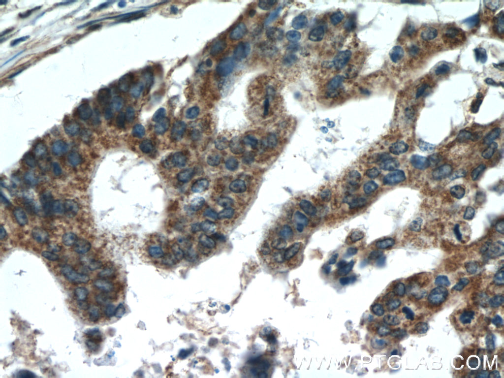 TMED2 Polyclonal antibody